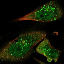 STAM2 Antibody, Novus Biologicals 25 &mu;L; Unlabeled:Antibodies, Polyclonal